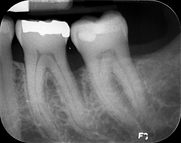 1 year-post op 2