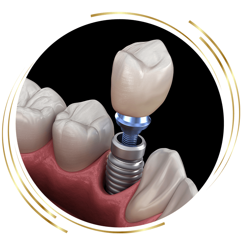 dental 3d