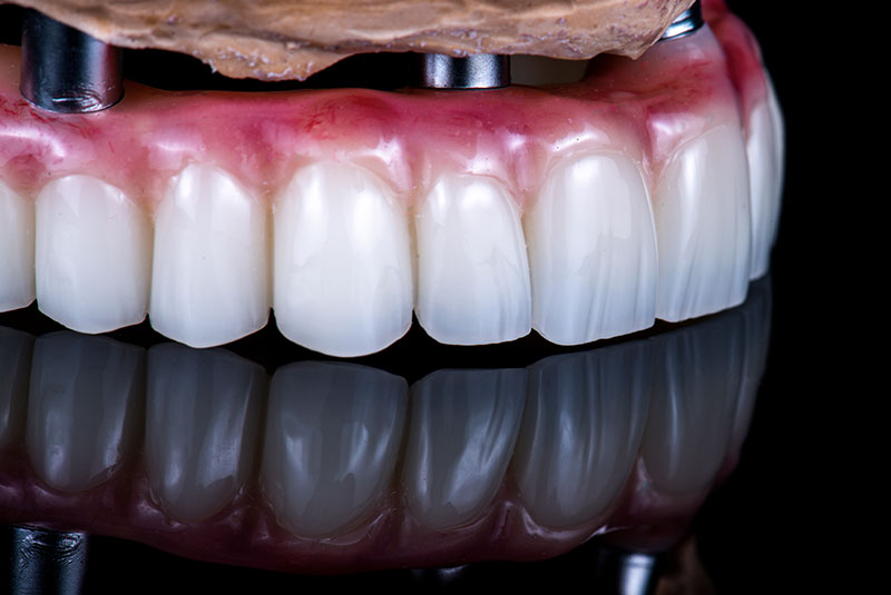 full arch 3d