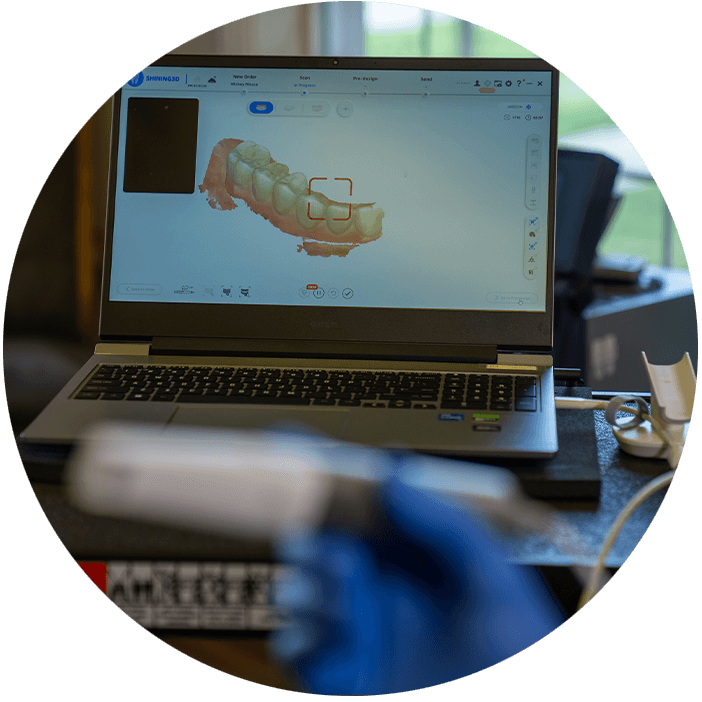 digital scan of patients teeth