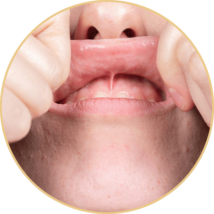 patient showing inside of mouth