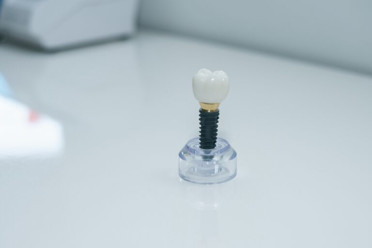 Periodontal specialist explaining dental implants to a patient